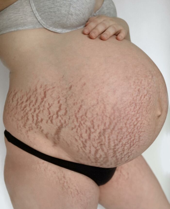 30 Mothers Are Sharing Realistic Pictures Of Baby Bumps And Pregnant Bodies To Fight Toxic Standards