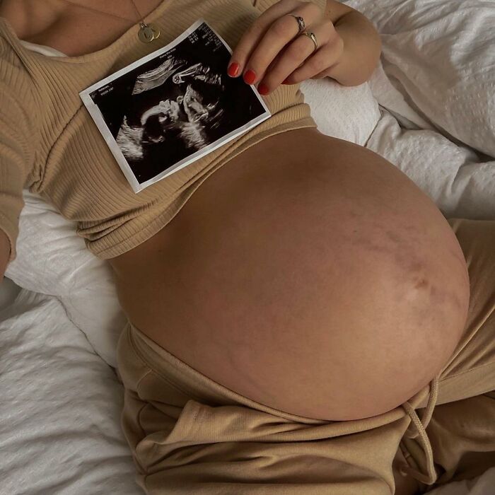 30 Mothers Are Sharing Realistic Pictures Of Baby Bumps And Pregnant Bodies To Fight Toxic Standards