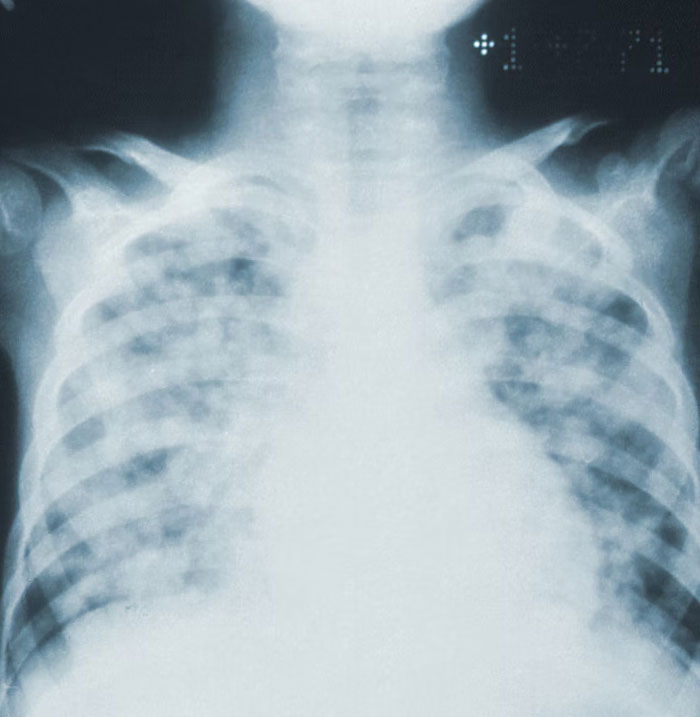 34 Personas que no se acordaban de cómo se llamaba una cosa y se inventaron un nuevo nombre más gracioso