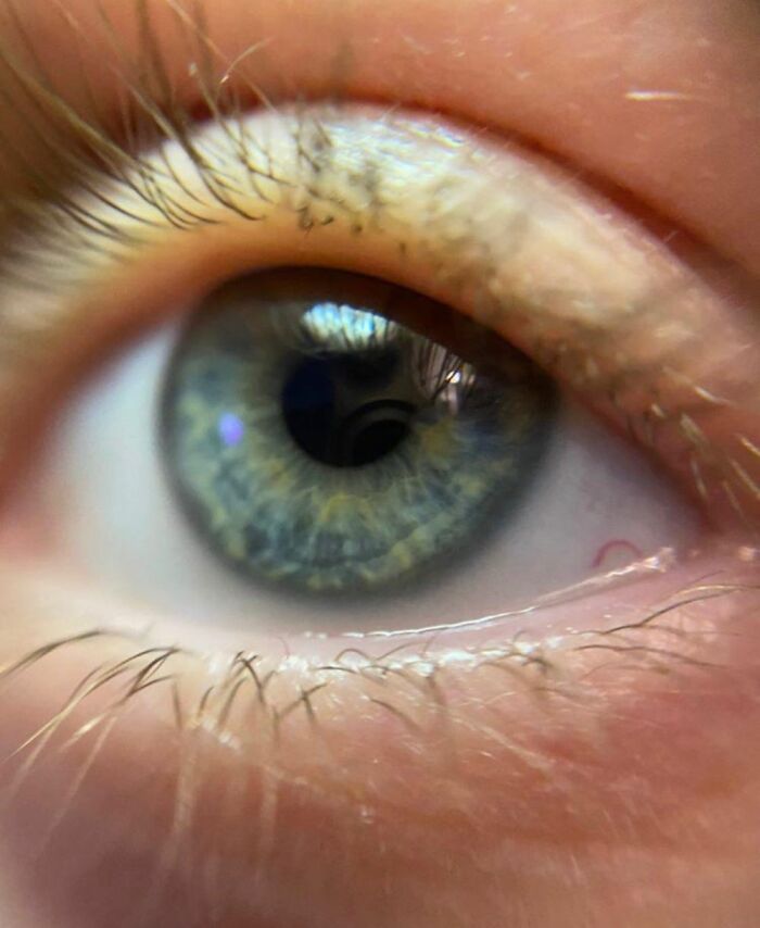 My Eyes Kinda Change Color From Blue To Green