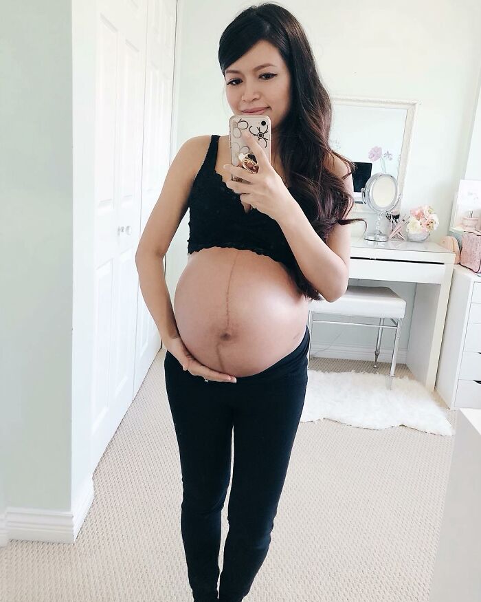 30 Mothers Are Sharing Realistic Pictures Of Baby Bumps And Pregnant Bodies To Fight Toxic Standards