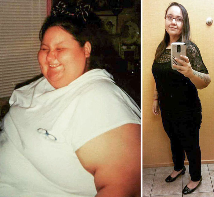 230 Lbs Gone Without Surgery