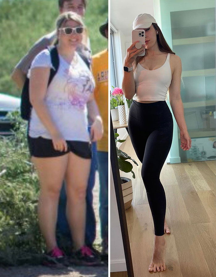 From 230 Lbs To 148 Lbs. I Lost 82 Lbs. Maintained For Two Years. Getting My Loose Skin Removal Surgery In Two Months As An Early 30th Birthday Gift To Myself