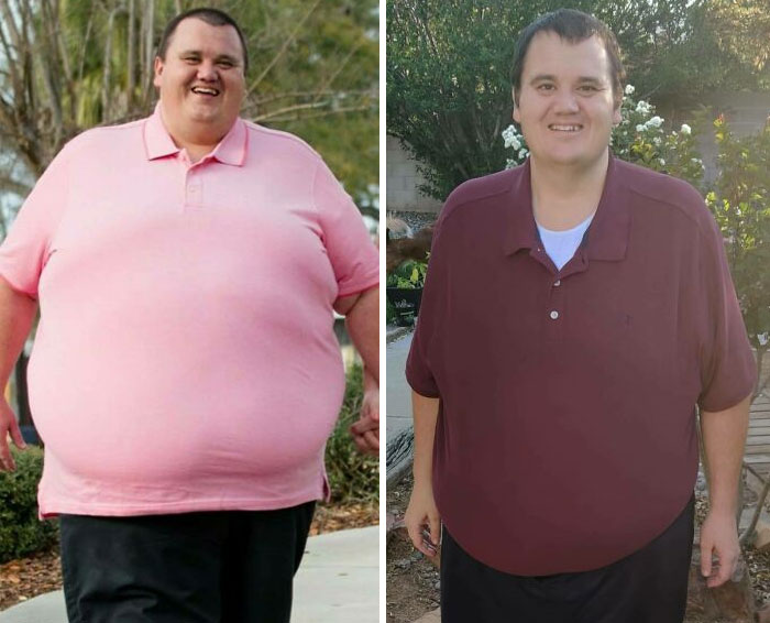 I've Lost The Average American Male In Weight! Highest Weight 527 Lbs In August 2020. 327 Lbs Today