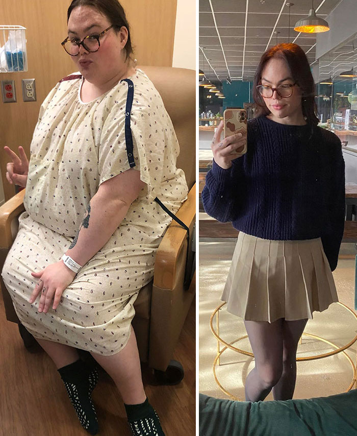 Face Gains From Losing 300 Lbs (485 vs. 180)