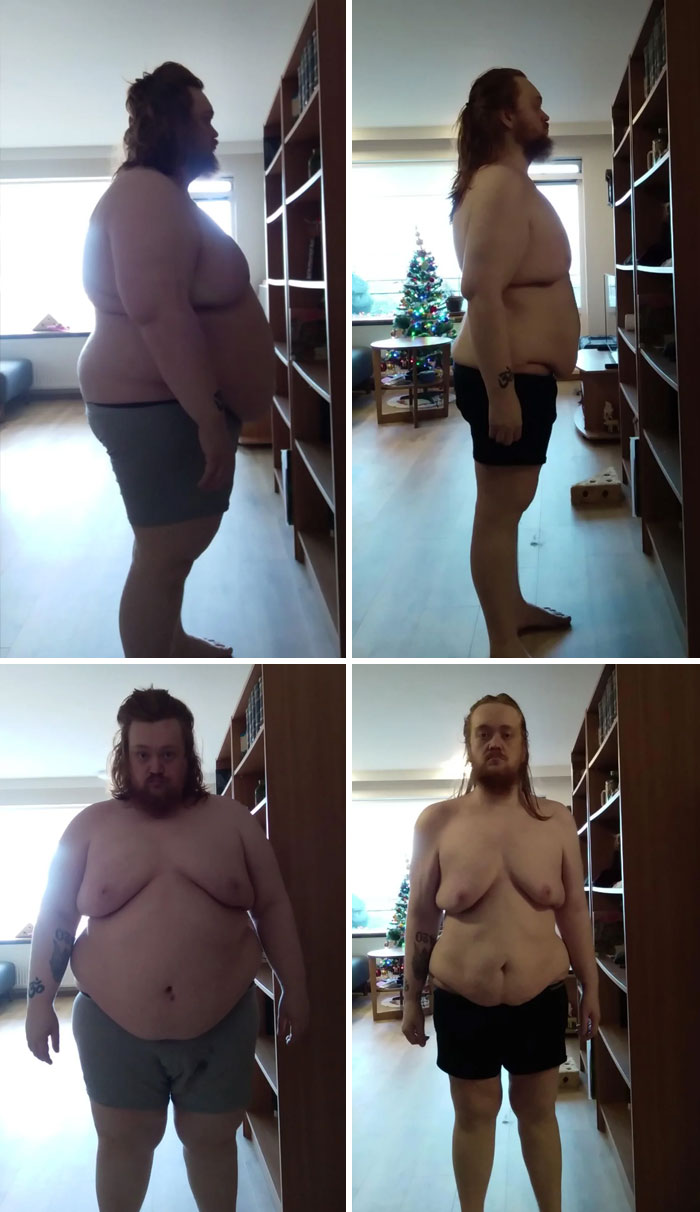 I Saw Others Share Their Transformations So I Thought Why Not. 79 Kg/174,2 Lbs Weight Loss. Started At 190 Kg Now 111 Kg