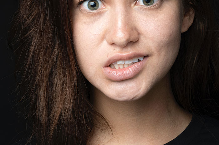 Woman crossing teeth 