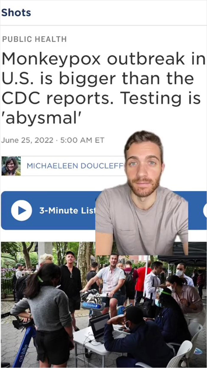 Monkeypox Is Starting To Spread More Widely And This Guy Shares What You Can Expect As He Went Through It Himself Monkeypox Is Starting To Spread More Widely And This Guy Shares What You Can Expect As He Went Through It Himself