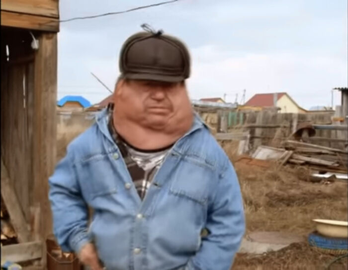 Man With Radium Poisoning, Ukraine 1990's