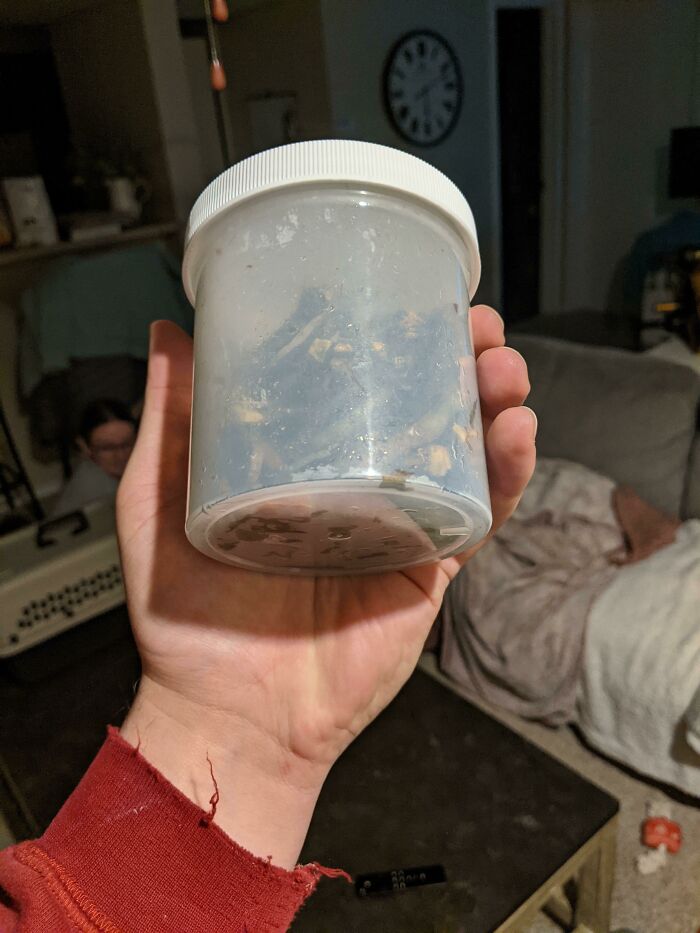 My Cat Had A Blockage In Her Stomach And Needed Surgery To Remove It. It Ended Up Being 26 Hair Ties