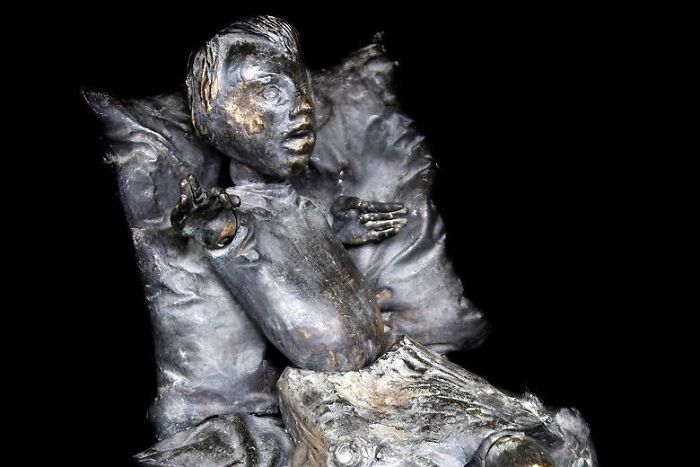 A Statue Of A Deformed Baby Unveiled By Grunenthal As A Commemoration To Pregnant Mothers To Whom They Advertised Thalidomide Was Completely Safe