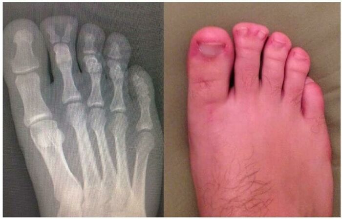 In The Middle Of Mi-Toe-Sis