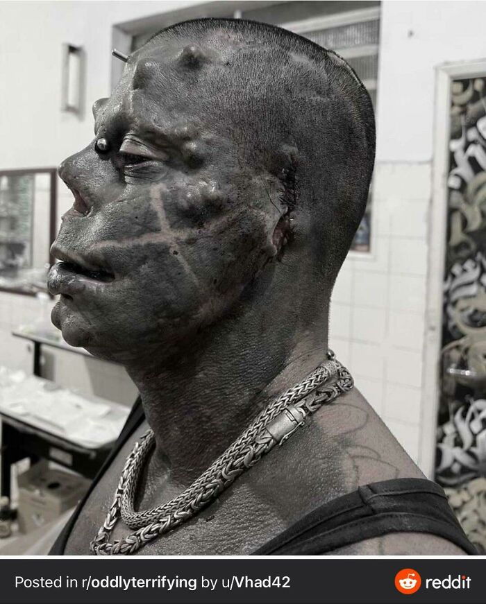 Brazil Man Known As "Diabão" (Big Devil), Famous For Doing Numerous Surgeries To Look Like The Devil, Celebrates The End Of Mask Mandate By Completely Removing His Ears
