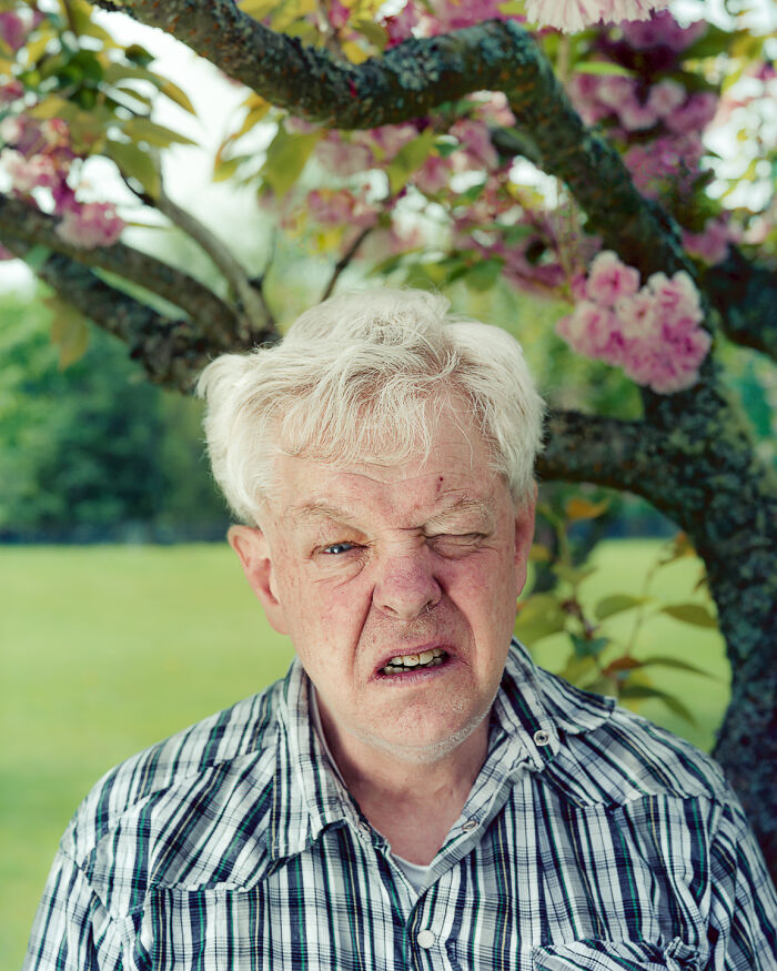 I Took Portraits Of People That Have Been Betrayed By Their Minds, And In Many Cases, Their Bodies (12 Pics)