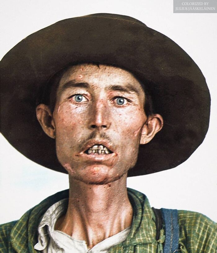 Mugshot Of Solomon Sivils Who Was Sentenced To 18 Months And Fined $10 For Introducing Liquor Into Indian Territory In 1904. In 1834 Legislation Was Passed Creating Penalties For The Sale, Barter, Or Introduction Of Alcohol Onto Native American Lands – With An Exception To Meet The Needs Of Members Of The United States Military That May Be Serving On Tribal Lands. The Reservation Ban On Alcohol, Coupled With A Prohibition Of Native Americans Being Sold Or Consuming Alcohol Even Off Reservations, Would Continue For Over A Century, Even After The 21st Amendment Ended National Prohibition