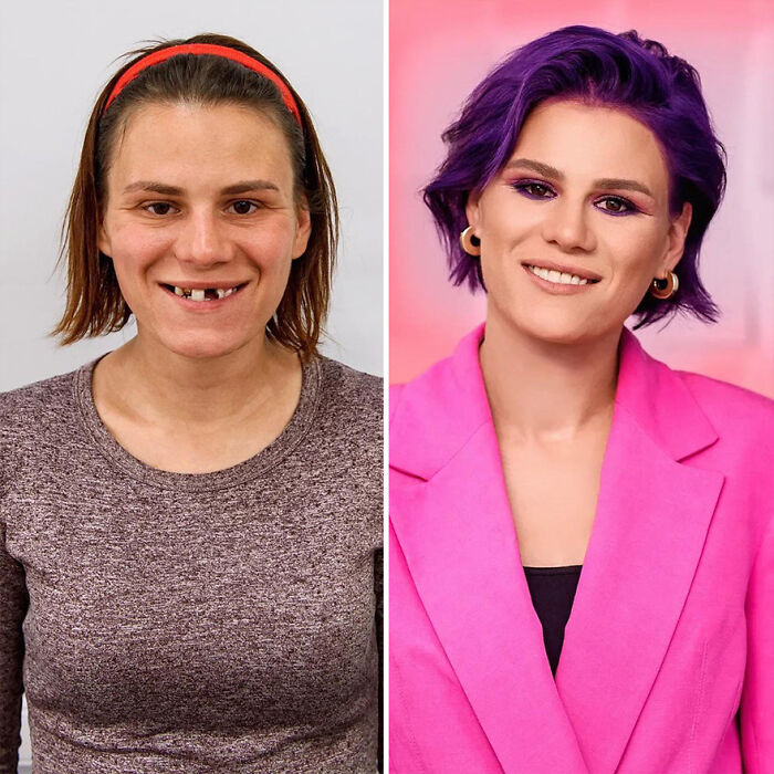 30 Transformations By This Hairstylist And His Team That Show The Power Of A Good Stylist (New Pics)