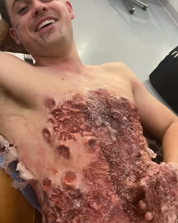 Dacre Montgomery Covered In Wounds