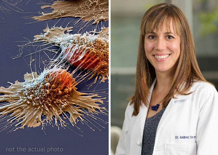 Unexpected Breakthrough In Cancer Drug Trial As All Patients Are Considered In Remission