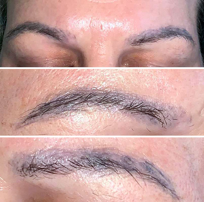 My Awful Eyebrows. Bad Microblading, Cheap Ink, Wrong Aftercare Directions. Now Look At Them