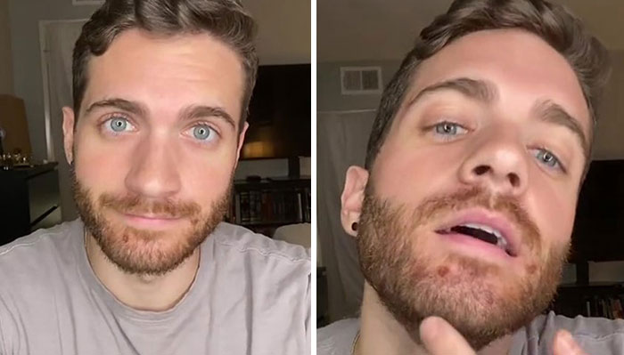 Monkeypox Is Starting To Spread More Widely And This Guy Shares What You Can Expect As He Went Through It Himself