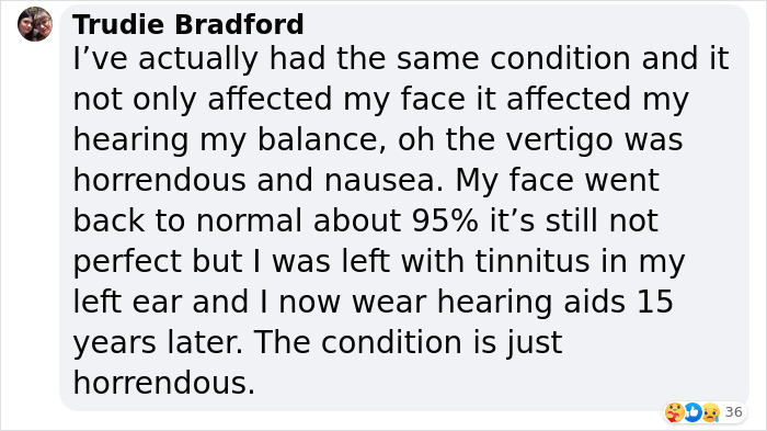 Justin Bieber Has Been Struck By Facial Paralysis, Leading To Ramsay Hunt Syndrome Diagnosis And Cancellation Of Shows Justin Bieber Has Been Struck By Facial Paralysis, Leading To Ramsay Hunt Syndrome Diagnosis And Cancellation Of Shows