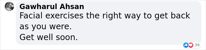 Justin Bieber Has Been Struck By Facial Paralysis, Leading To Ramsay Hunt Syndrome Diagnosis And Cancellation Of Shows Justin Bieber Has Been Struck By Facial Paralysis, Leading To Ramsay Hunt Syndrome Diagnosis And Cancellation Of Shows
