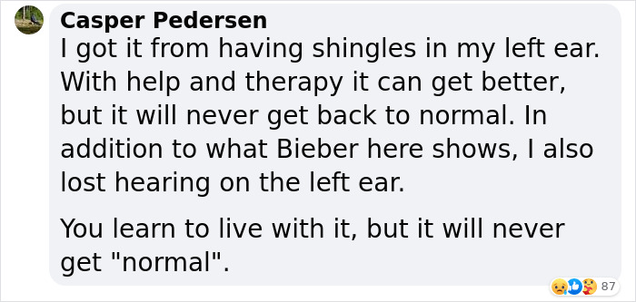 Justin Bieber Has Been Struck By Facial Paralysis, Leading To Ramsay Hunt Syndrome Diagnosis And Cancellation Of Shows Justin Bieber Has Been Struck By Facial Paralysis, Leading To Ramsay Hunt Syndrome Diagnosis And Cancellation Of Shows