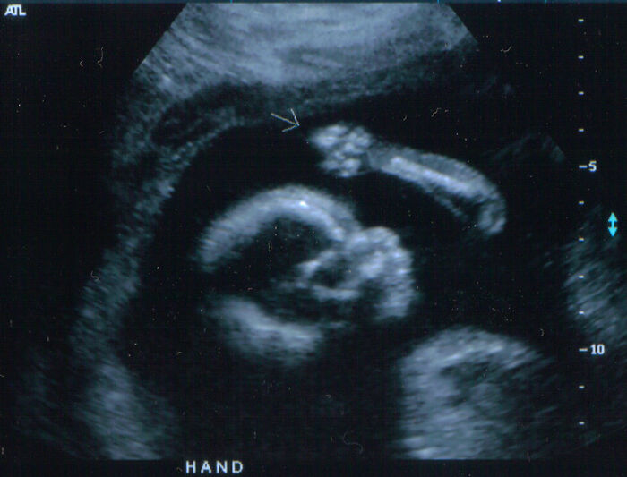 40 Times People Encountered Someone So Blatantly Stupid, They Just Had To Share It In This Online Group