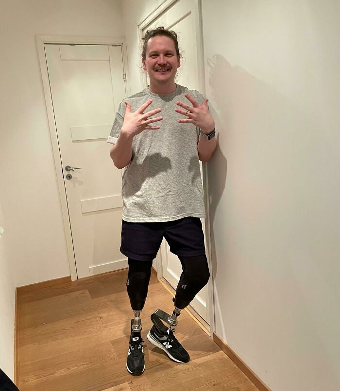 My Radiotherapy Treatments Worked! Most Tumors Has Reduced In Size And Are Less Painful