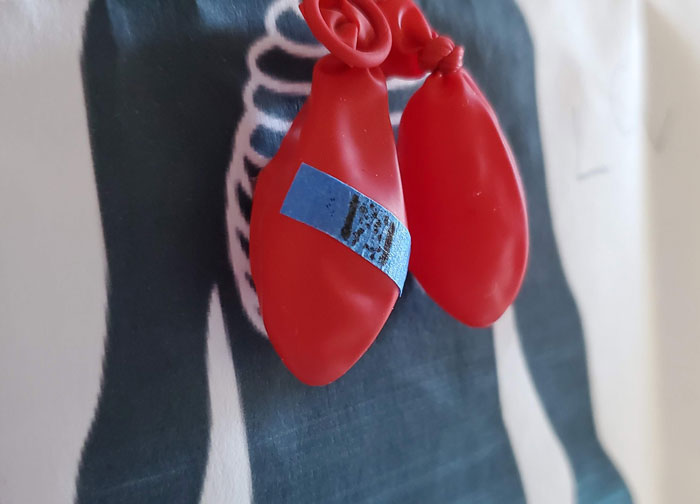 Person Asks “Doctors, What Was The Worst Thing You’ve Seen In A Patient That Another Doctor Overlooked?”, And 30 Folks Deliver