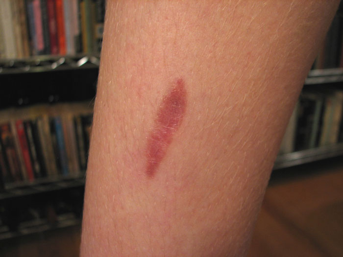 Person Asks “Doctors, What Was The Worst Thing You’ve Seen In A Patient That Another Doctor Overlooked?”, And 30 Folks Deliver