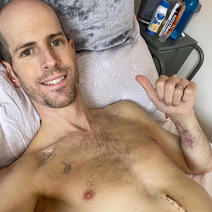 Dad Saved By Liver Transplant Shares Pictures Taken Before And After, Showing His Remarkable Recovery - 3