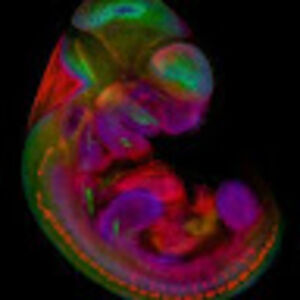 xhitfacedfetus avatar