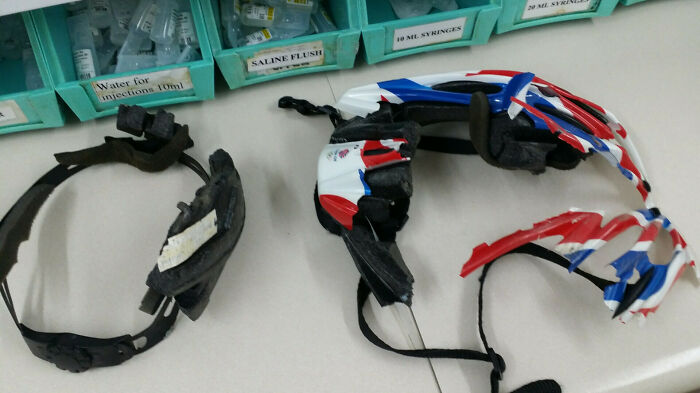 Un ciclista llegó a urgencias con este casco, sorprendentemente bien. Imagina su cráneo sin casco