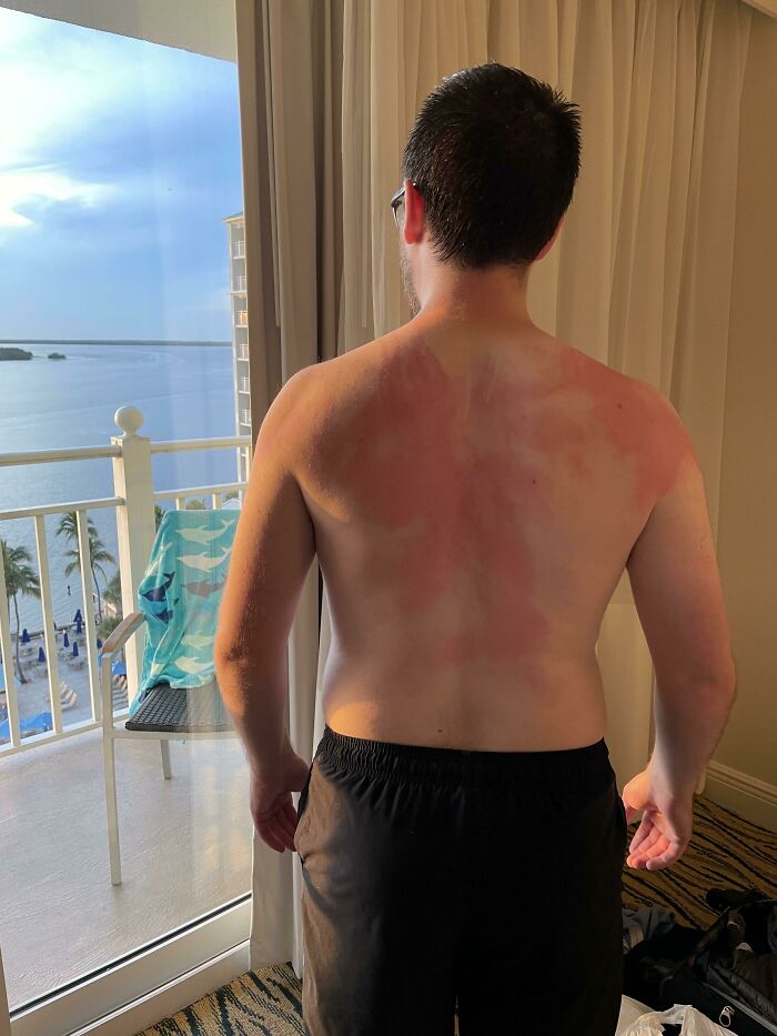 My Fiancée Was In Charge Of Getting My Back