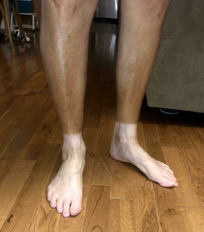 My Grandfather’s Two-Toned Feet From Working Outside His Whole Life