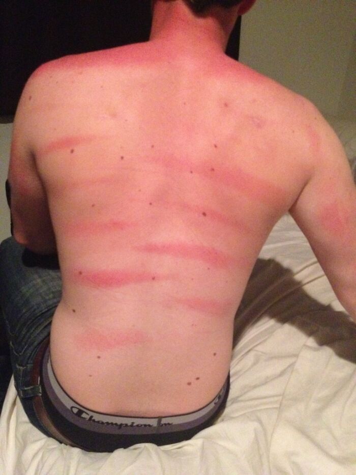 Spray Sunscreen Would Provide Adequate Coverage They Said