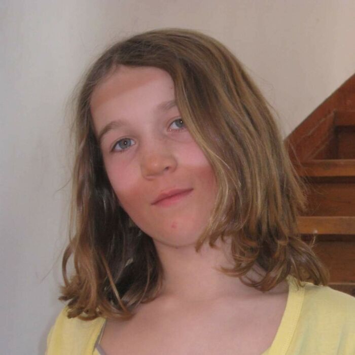 At My School This Skiing Goggles Tan Line Was A Status Symbol