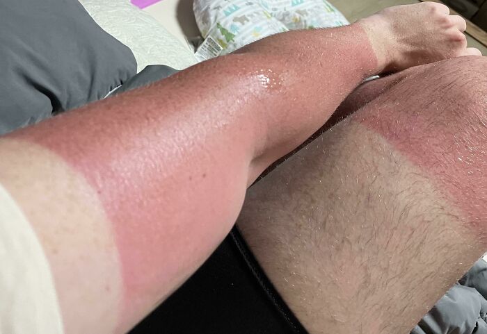 I See Your Tans And Raise You A Fry