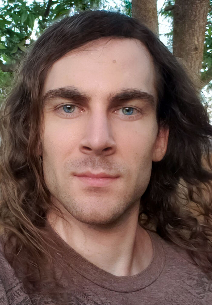 Both Of My Eyes Are Split Between Two Colors