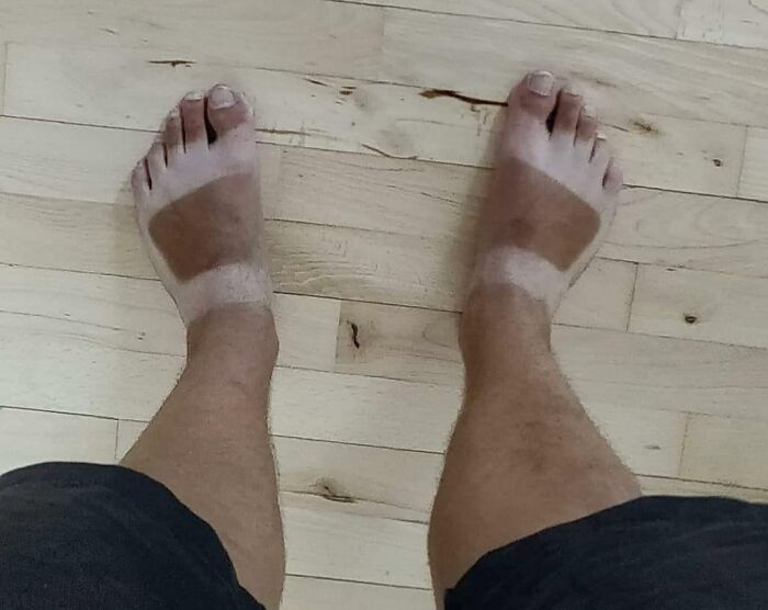 Tan Line From The Time I Was Living In Vietnam