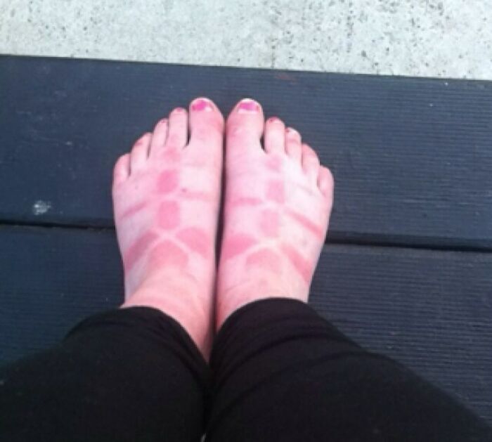 Starting To Really Understand The Reasoning Behind The Whole Socks And Sandals Thing