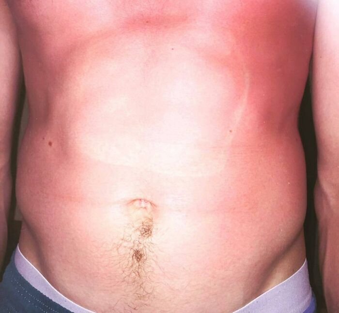 Leigh Left His Sunglasses On