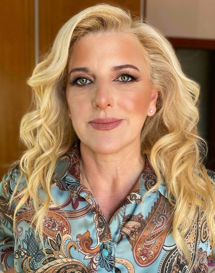 Orangy Brown Foreheads And Cheeks