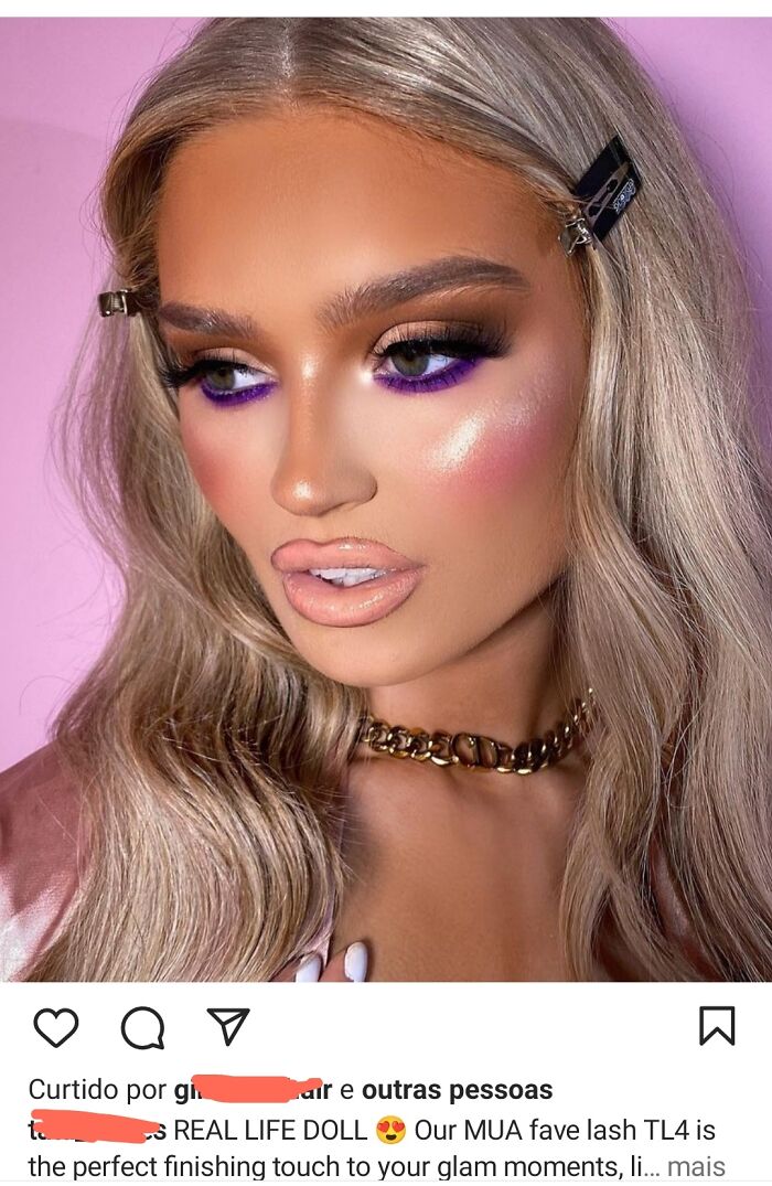 The Forehead Contour