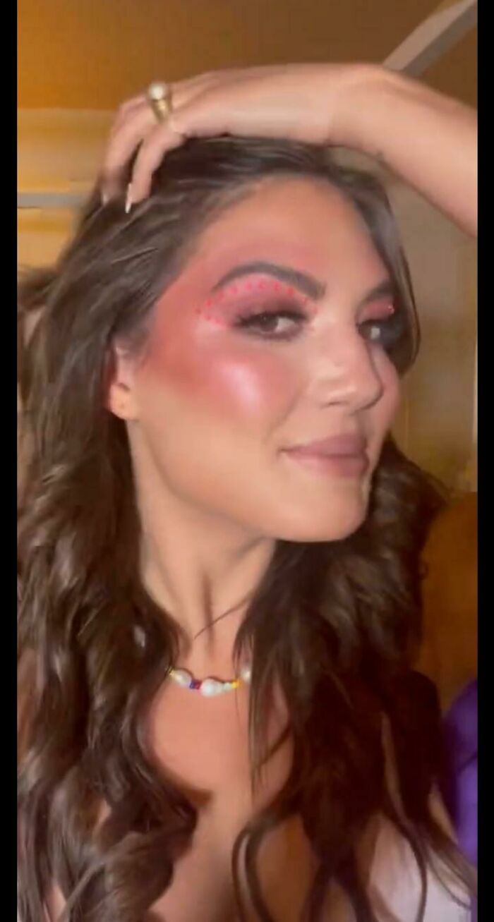 I Just Can't With This. It Looks Like A Big Bruise