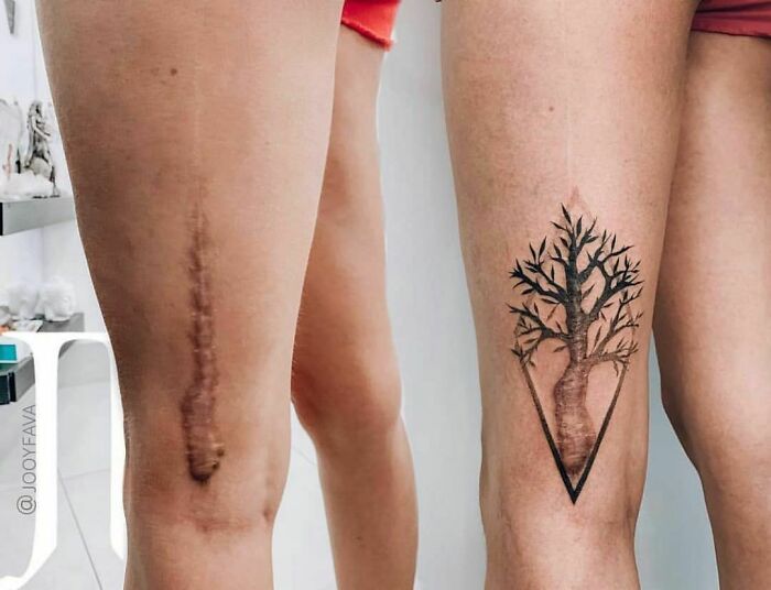Two legs showcasing creative tattoos, with a tree design incorporated into a scar.