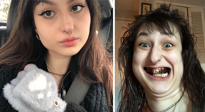 Tw: Disgusting. I Have Absolutely No Idea How I Did This