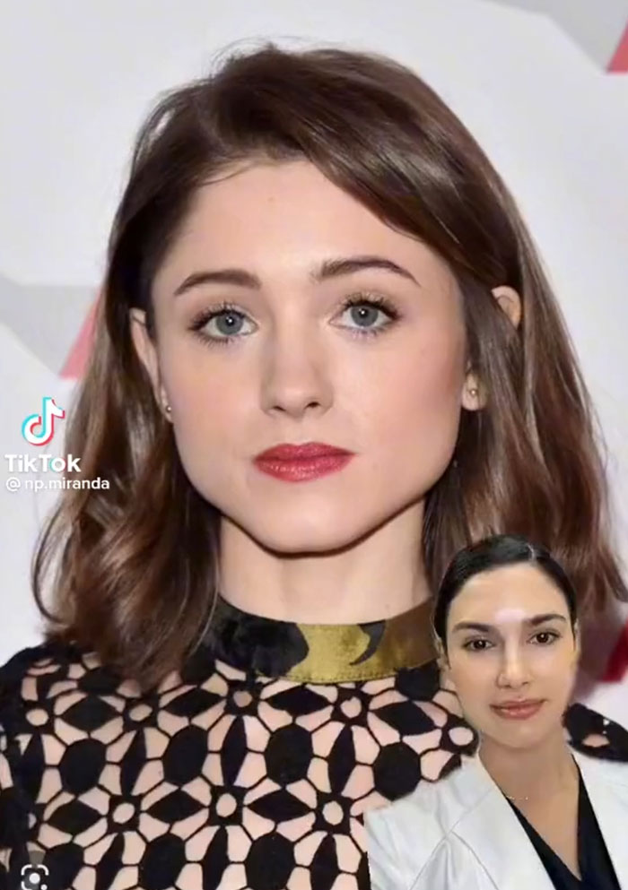 "This Is Why Everyone Looks The Same": People Slam This Nurse Injector For Giving Natalia Dyer A Face Transformation