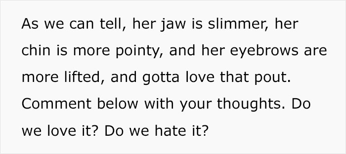 "This Is Why Everyone Looks The Same": People Slam This Nurse Injector For Giving Natalia Dyer A Face Transformation